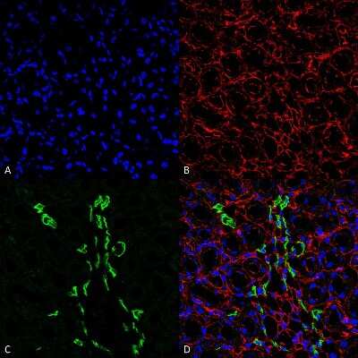 Immunohistochemistry UT2/SLC14A2 Antibody